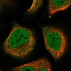 DHPS Antibody, Novus Biologicals:Antibodies:Primary Antibodies